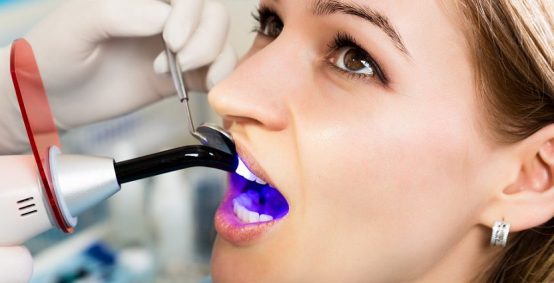 Cosmetic Dental Bonding Arlington Heights