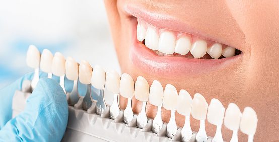 Dental Fillings in Arlington Heights IL