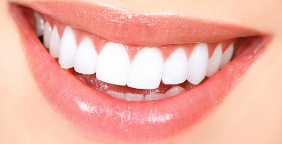 Teeth Whitening Services Kensington