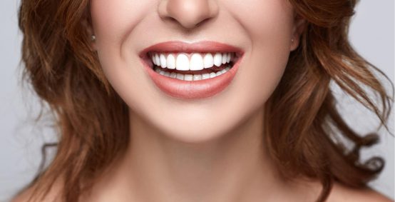 Porcelain Dental Veneers Arlington Heights