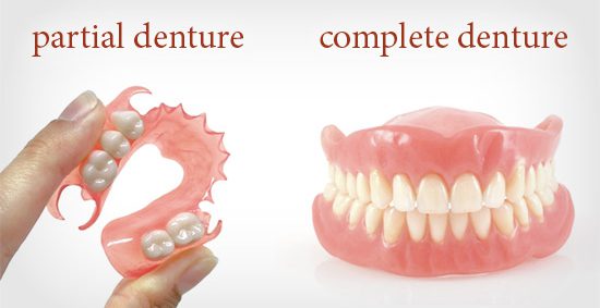 Dentures Services in Arlington Heights