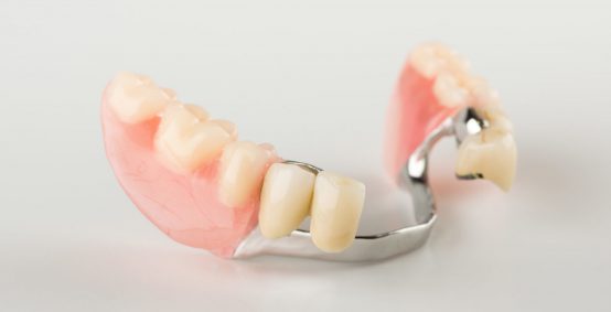 Dentures Services in Arlington Heights