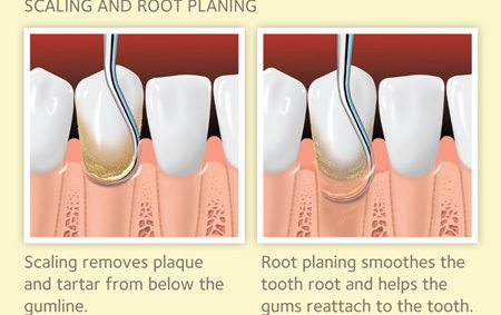 Periodontist Arlington Heights Il