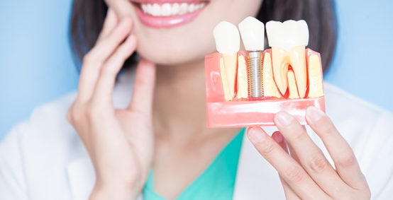 Dental Implants Arlington Heights