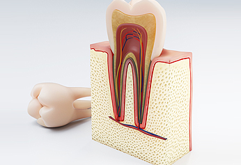 Root Canals